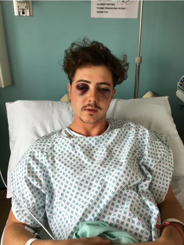 被误认是车迷,热刺球迷被暴打