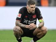 巴代接近复出，图片报：此前关键战失误的安德里希首发受冲击