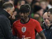 TA：因膝盖受伤，马杜埃凯能否出战对阵葡体的首场比赛存疑