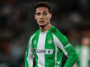 佩莱格里尼：安东尼各方面都有一点问题，必须继续谨慎使用