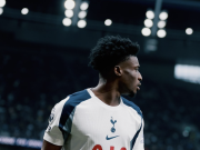 热刺官方：库杜斯伤情出现反复，可能需要接受手术