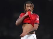 啊？记者：约罗因伤未随队出征，曼联五名中卫里四人将缺战切尔西