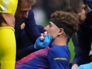 世体：费尔明佩戴定制防护面具，在今日重返训练场