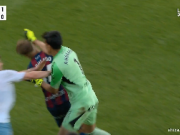 西乙萨拉戈萨门将比赛中拳击对手，致其面部肿胀眼部淤青